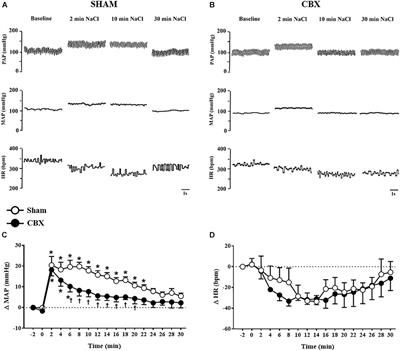 Role of the Carotid Bodies in the Hypertensive and Natriuretic Responses to NaCl Load in Conscious Rats